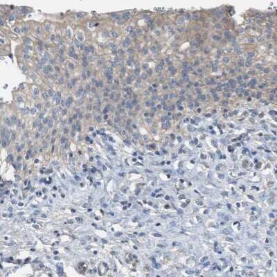 Immunohistochemistry-Paraffin: NQO-2 Antibody [NBP1-85221]