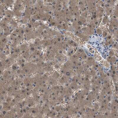 Immunohistochemistry-Paraffin: NQO-2 Antibody [NBP1-85221]