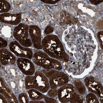 Immunohistochemistry-Paraffin: NQO-2 Antibody [NBP1-85222]