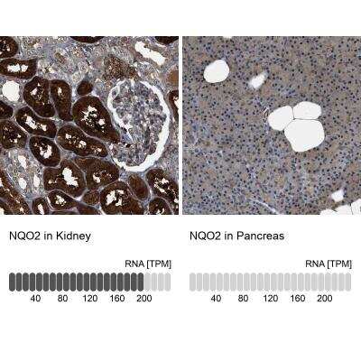 Immunohistochemistry-Paraffin: NQO-2 Antibody [NBP1-85222]