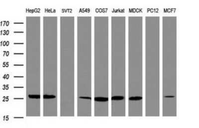 Western Blot: NQO-2 Antibody (OTI3C11)Azide and BSA Free [NBP2-73045]
