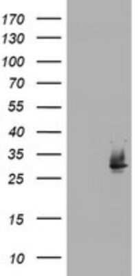 Western Blot: NQO-2 Antibody (OTI3C11)Azide and BSA Free [NBP2-73045]