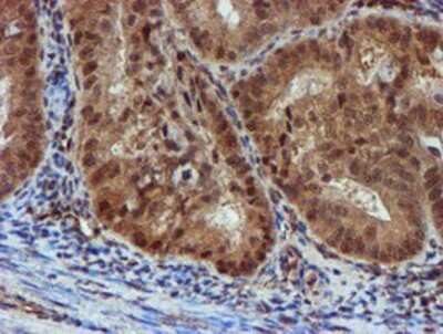 Immunohistochemistry: NQO-2 Antibody (OTI3G4) - Azide and BSA Free [NBP2-73049]