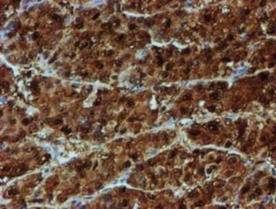 Immunohistochemistry: NQO-2 Antibody (OTI3G4) - Azide and BSA Free [NBP2-73049]