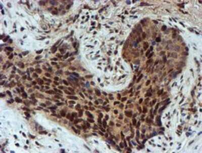 Immunohistochemistry: NQO-2 Antibody (OTI3G4) - Azide and BSA Free [NBP2-73049]