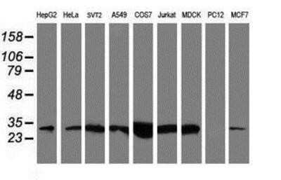 Western Blot: NQO-2 Antibody (OTI3G4)Azide and BSA Free [NBP2-73049]