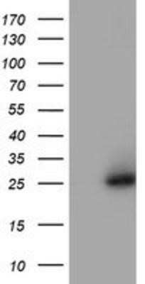 Western Blot: NQO-2 Antibody (OTI3G4)Azide and BSA Free [NBP2-73049]