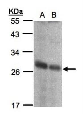 Western Blot: NQO-2 Antibody [NBP1-31563]