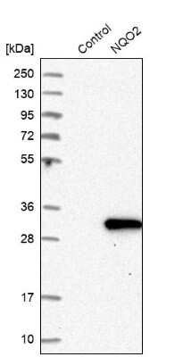 Western Blot: NQO-2 Antibody [NBP1-85222]