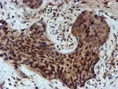 Immunohistochemistry-Paraffin: NQO-2 Antibody (OTI3G4) [NBP2-02062]