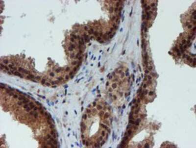 Immunohistochemistry-Paraffin: NQO-2 Antibody (OTI3G4) [NBP2-02062]