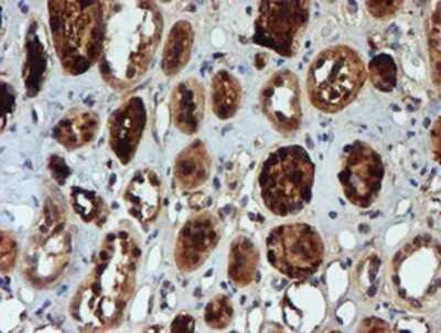Immunohistochemistry-Paraffin: NQO-2 Antibody (OTI3G4) [NBP2-02062]