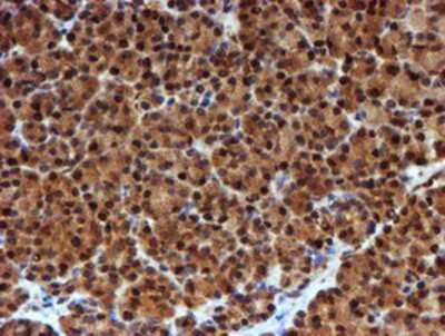 Immunohistochemistry-Paraffin: NQO-2 Antibody (OTI3G4) [NBP2-02062]