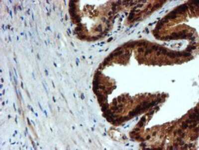 Immunohistochemistry-Paraffin: NQO-2 Antibody (OTI3G4) [NBP2-02062]