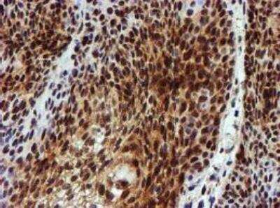 Immunohistochemistry-Paraffin: NQO-2 Antibody (OTI3G4) [NBP2-02062]