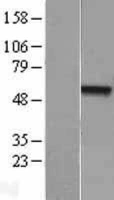 Western Blot: DAX1/NR0B1 Overexpression Lysate [NBL1-13764]