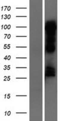 Western Blot: Rev-erb A alpha/NR1D1 Overexpression Lysate [NBP2-06523]