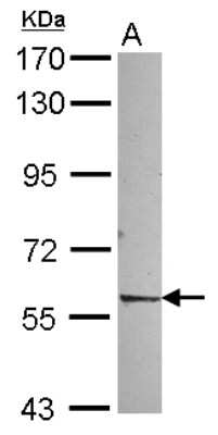 Western Blot: Rev-erb beta/NR1D2 Antibody [NBP2-19576]