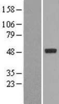 Western Blot: PXR/NR1I2 Overexpression Lysate [NBL1-13770]