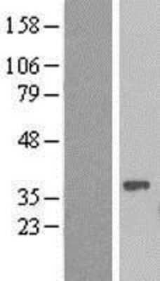 Western Blot: CAR/NR1I3 Overexpression Lysate [NBP2-08456]