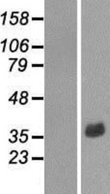 Western Blot: CAR/NR1I3 Overexpression Lysate [NBP2-09261]