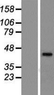 Western Blot: CAR/NR1I3 Overexpression Lysate [NBP2-09262]