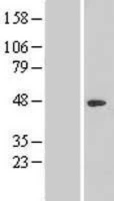 Western Blot: TR2/NR2C1 Overexpression Lysate [NBL1-13771]