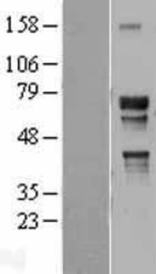 Western Blot: TR4/NR2C2 Overexpression Lysate [NBL1-13772]