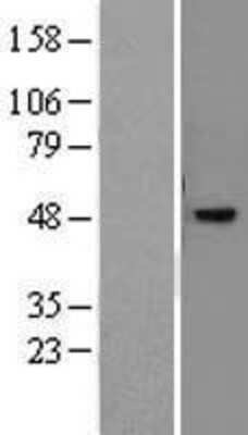 Western Blot: PNR/NR2E3 Overexpression Lysate [NBL1-13774]