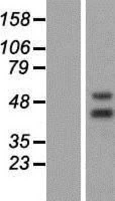 Western Blot: PNR/NR2E3 Overexpression Lysate [NBP2-07051]