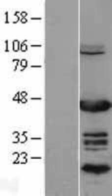 Western Blot: EAR2/NR2F6 Overexpression Lysate [NBL1-13776]