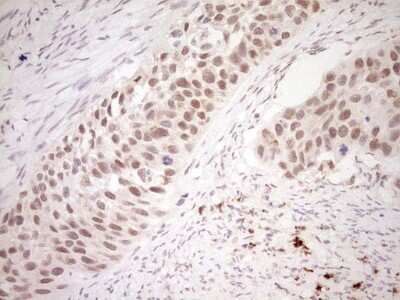 Immunohistochemistry: NR4A3/NOR1 Antibody (OTI5C2) [NBP2-46246]