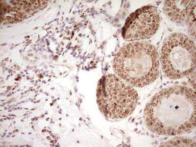Immunohistochemistry-Paraffin: NR4A3/NOR1 Antibody (OTI5C2) [NBP2-46246]