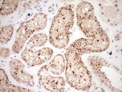 Immunohistochemistry-Paraffin: NR4A3/NOR1 Antibody (OTI5C2) [NBP2-46246]