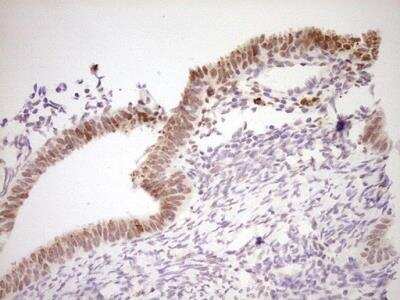 Immunohistochemistry-Paraffin: NR4A3/NOR1 Antibody (OTI5C2) [NBP2-46246]