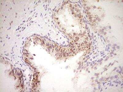Immunohistochemistry-Paraffin: NR4A3/NOR1 Antibody (OTI5C2) [NBP2-46246]