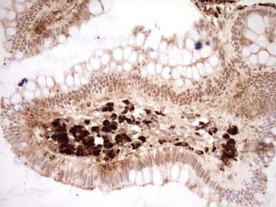 Immunohistochemistry-Paraffin: NR4A3/NOR1 Antibody (OTI5C2) [NBP2-46246]