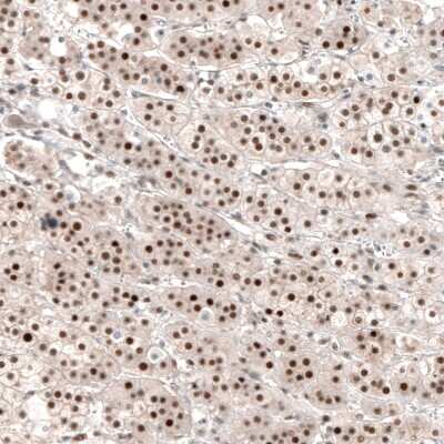 Immunohistochemistry-Paraffin: NR4A3/NOR1 Antibody [NBP1-92198]