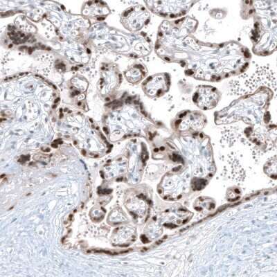 Immunohistochemistry-Paraffin: NR4A3/NOR1 Antibody [NBP1-92198]