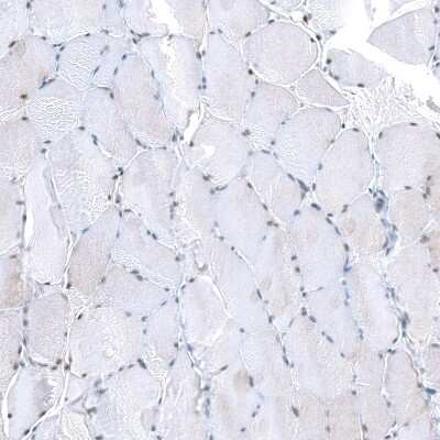 Immunohistochemistry-Paraffin: NR4A3/NOR1 Antibody [NBP1-92198]