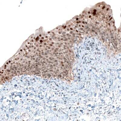 Immunohistochemistry-Paraffin: NR4A3/NOR1 Antibody [NBP1-92198]