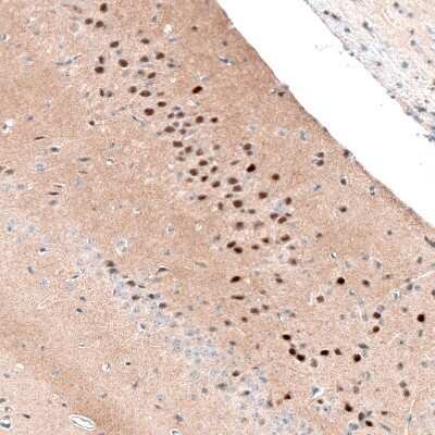 Immunohistochemistry-Paraffin: NR4A3/NOR1 Antibody [NBP1-92198]