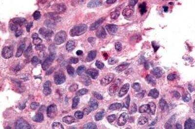 Immunohistochemistry-Paraffin: NR4A3/NOR1 Antibody - BSA Free [NLS2341]