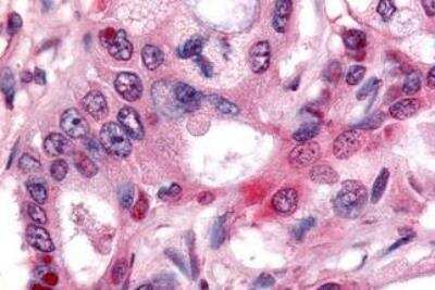 Immunohistochemistry-Paraffin: NR4A3/NOR1 Antibody - BSA Free [NLS2341]