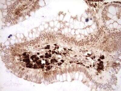 Immunohistochemistry: NR4A3/NOR1 Antibody (OTI5C2) - Azide and BSA Free [NBP2-73052]