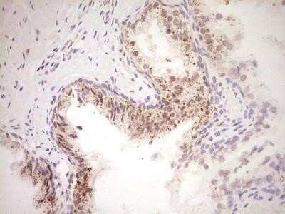 Immunohistochemistry: NR4A3/NOR1 Antibody (OTI5C2) - Azide and BSA Free [NBP2-73052]