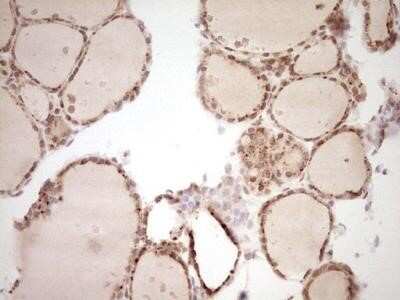 Immunohistochemistry: NR4A3/NOR1 Antibody (OTI5C2) - Azide and BSA Free [NBP2-73052]