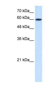 Western Blot: NR4A3/NOR1 Antibody [NBP1-55295]