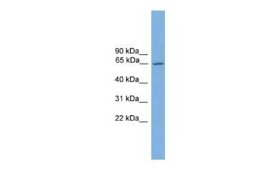 Western Blot: NR4A3/NOR1 Antibody [NBP3-10423]