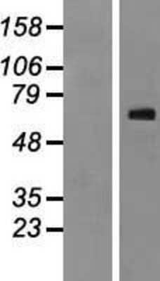 Western Blot: NR4A3/NOR1 Overexpression Lysate [NBP2-05143]